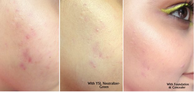 How to Choose and Apply Color Correcting Concealers