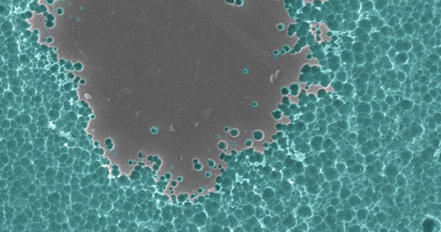 End of global polution? Scientists Accidentally Create Plastic-Eating Enzyme