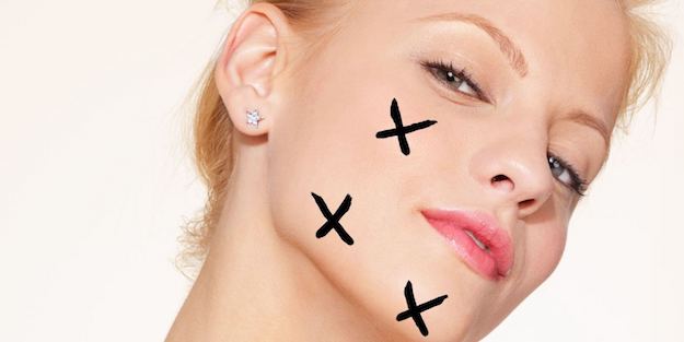 How to Get Rid of Acne Scars How to Deal With the Scars Of Acne! Learn Some Treatments That’ll Help