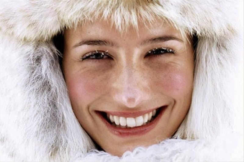 Do You Have Flaky Skin? Here is How To Save It From Cold!