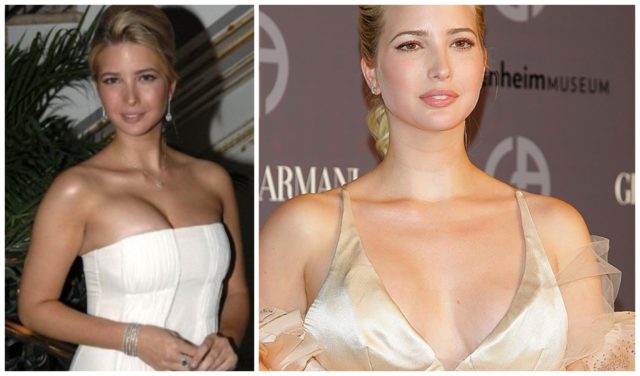 In The Race For Beauty Standards: Celebrities With Unsuccessful Breast Reconstruction&#8230;