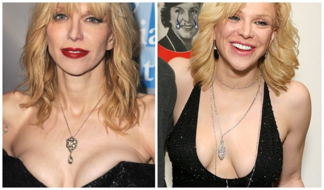 In The Race For Beauty Standards: Celebrities With Unsuccessful Breast Reconstruction&#8230;