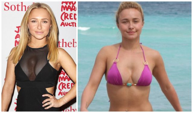 Грудь генсцхи до и после операции In The Race For Beauty Standards: Celebrities With Unsuccessful Breast Reconstru