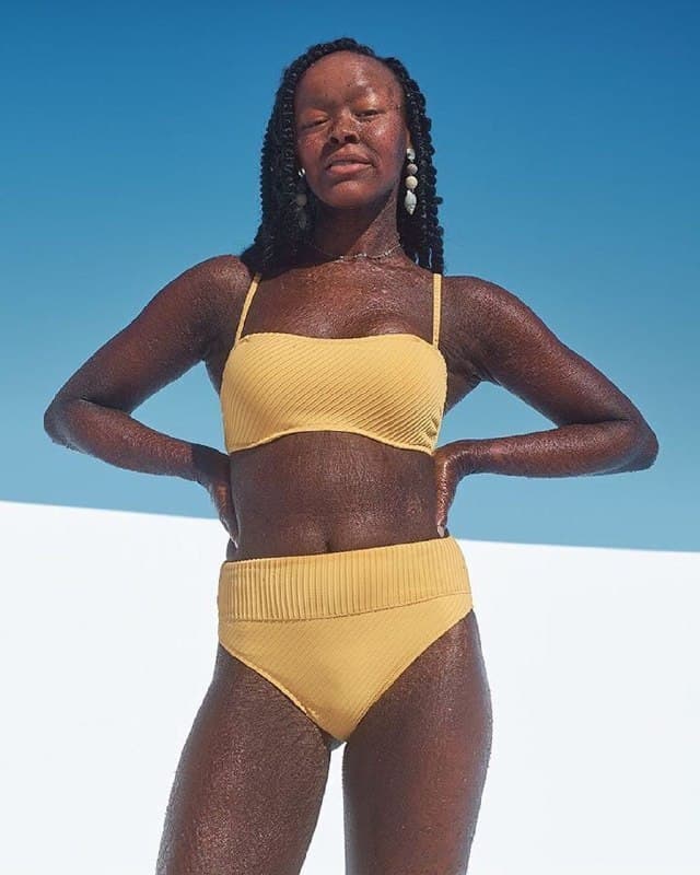 Girl With Scaly Skin Became A Model