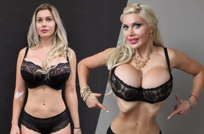 WHO Are Celebrities Who Have Removed Their Ribs Trying To Achieve An Ideal Body! 6 WHO Are Celebrities Who Have Removed Their Ribs Trying To Achieve An Ideal Body!