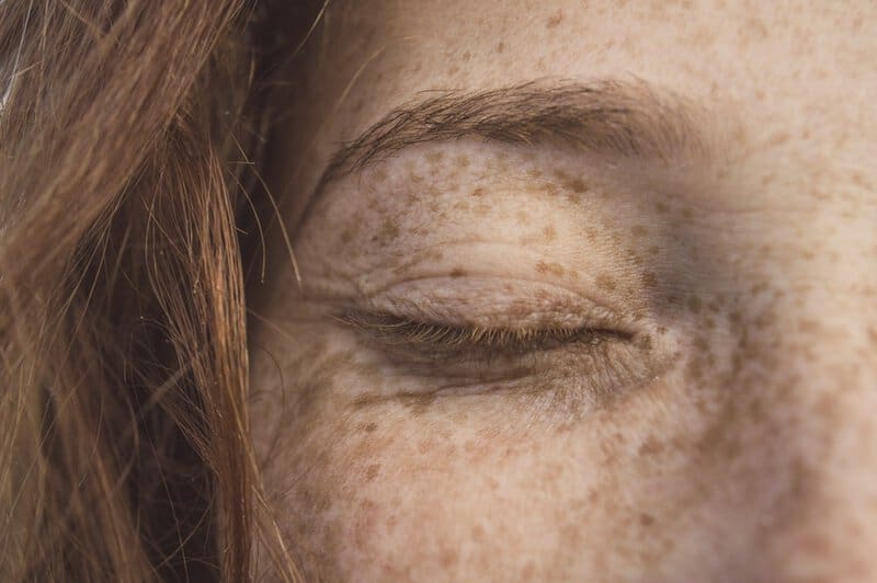 Do Redheads Have A Huge Genetic Advantage? 3 Do Redheads Have A Huge Genetic Advantage?