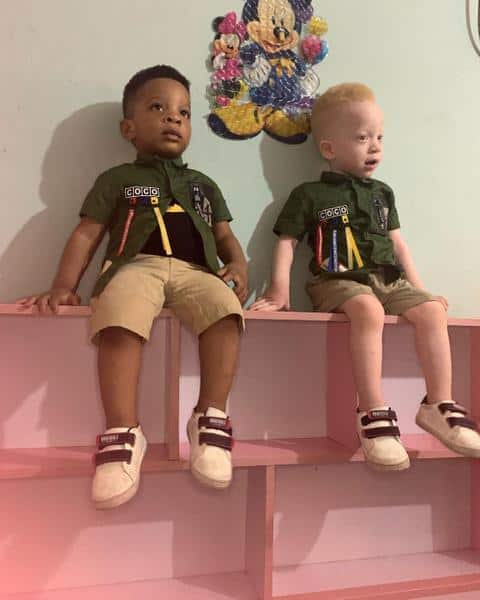 The twin of a dark-skinned baby turned out to be a red-haired albino - what unusual brothers look like 1 The twin of a dark-skinned baby turned out to be a red-haired albino – what unusual brothers look like