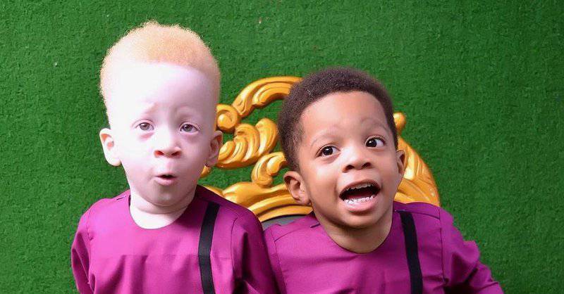 The twin of a dark-skinned baby turned out to be a red-haired albino – what unusual brothers look like